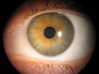 Ein Auge mit stark gemischten Blau-und Braunt&ouml;nen mit Zickzack-Krause