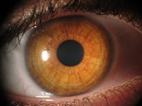 Ein Auge mit einer vollst&auml;ndig braunen Iris