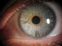 Ein Auge mit einer mittelblauen Iris, die im Randbereich wei&szlig;-gelbe Fl&ouml;ckchen aufweist