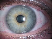 Ein Auge mit einer blauen Iris
